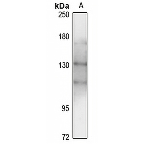 TYK2 Rabbit Polyclonal Antibody