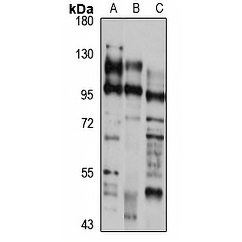 TYRO3 Rabbit Polyclonal Antibody