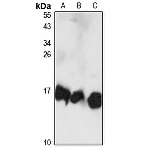 UBE2D3 Rabbit Polyclonal Antibody