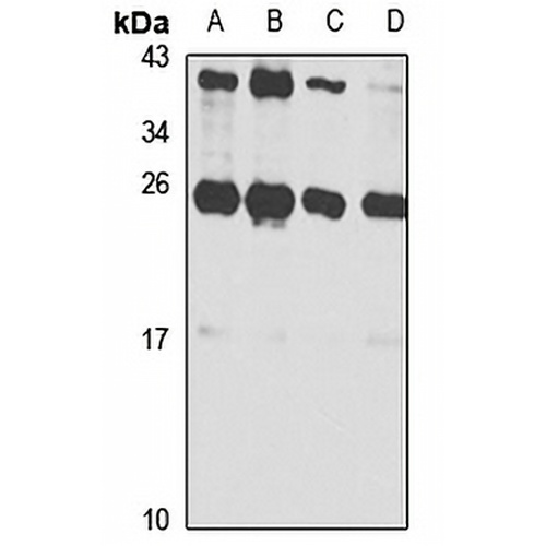 UBE2K Rabbit Polyclonal Antibody