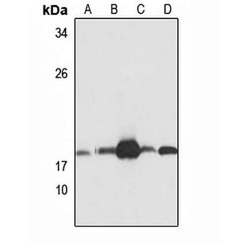 UBE2L6 Rabbit Polyclonal Antibody
