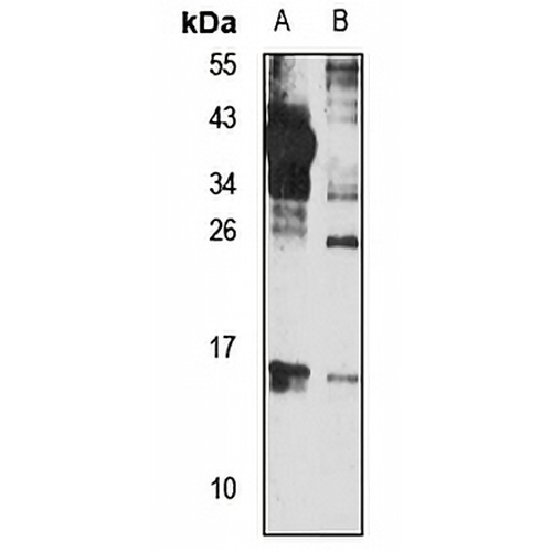 UBE2W Rabbit Polyclonal Antibody
