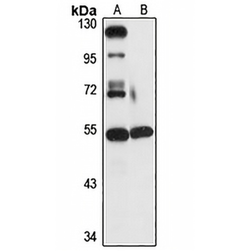 UBQLNL Rabbit Polyclonal Antibody