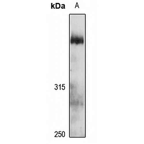 UBR4 Rabbit Polyclonal Antibody