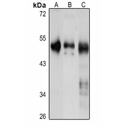 UBR7 Rabbit Polyclonal Antibody