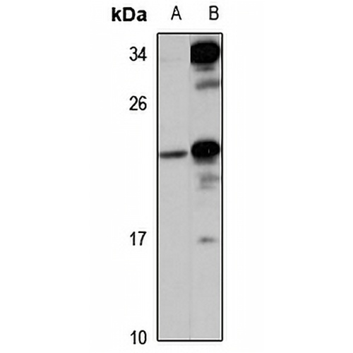 UFC1 Rabbit Polyclonal Antibody