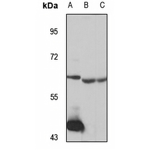 UGT2B15 Rabbit Polyclonal Antibody