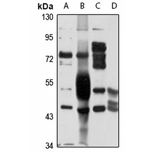 UGT2B4 Rabbit Polyclonal Antibody