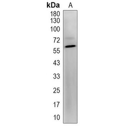 UGT2B7 Rabbit Polyclonal Antibody