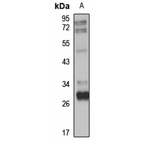 ULBP1 Rabbit Polyclonal Antibody