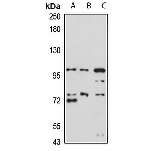 UNC5B Rabbit Polyclonal Antibody