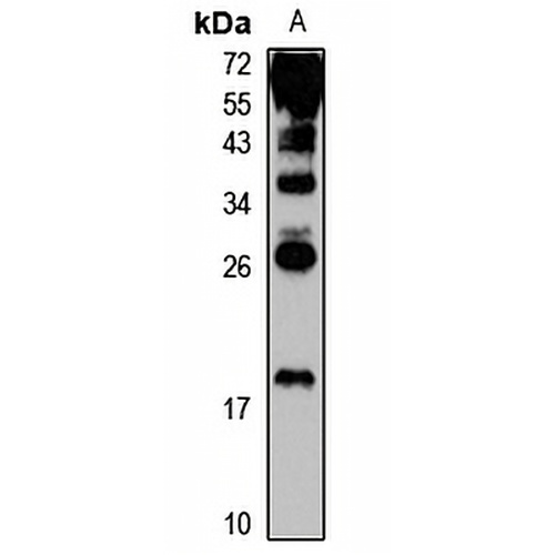 UP2 Rabbit Polyclonal Antibody