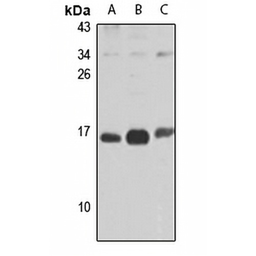 UQCC2 Rabbit Polyclonal Antibody