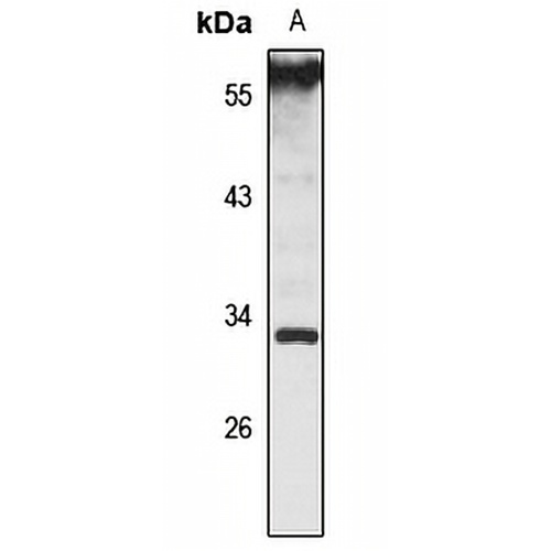 USE1 Rabbit Polyclonal Antibody