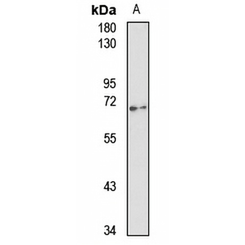 USP22 Rabbit Polyclonal Antibody