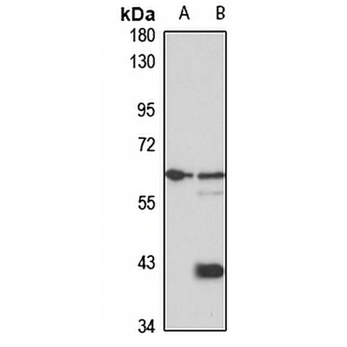 USP22 Rabbit Polyclonal Antibody