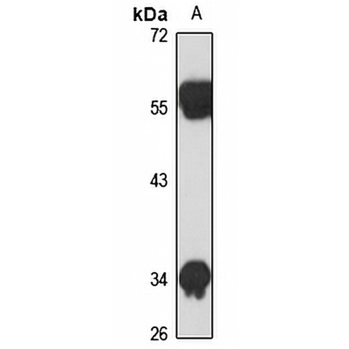 USP46 Rabbit Polyclonal Antibody