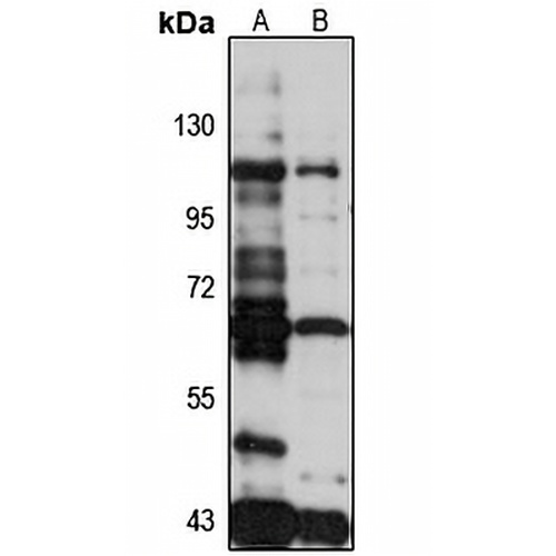 USP53 Rabbit Polyclonal Antibody