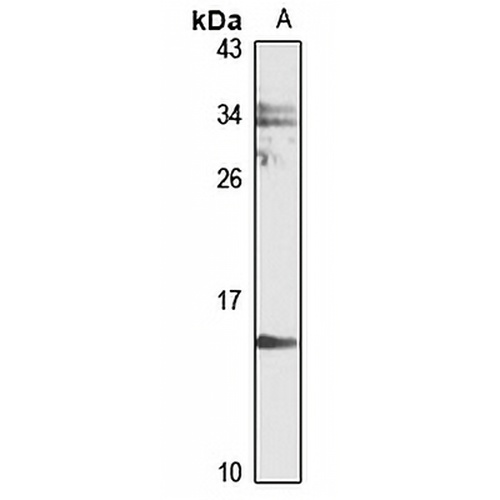 UXT Rabbit Polyclonal Antibody