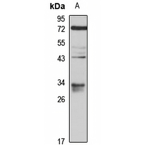 VDAC3 Rabbit Polyclonal Antibody