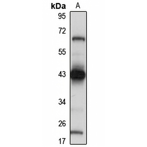 VMP1 Rabbit Polyclonal Antibody