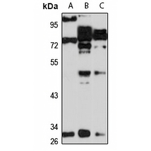 VNN2 Rabbit Polyclonal Antibody