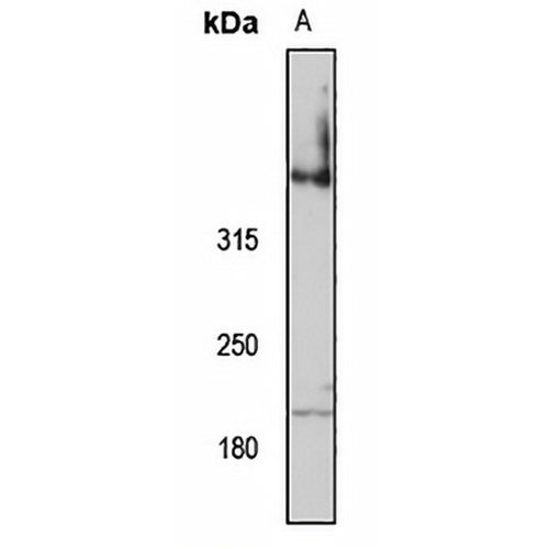 VPS13A Rabbit Polyclonal Antibody