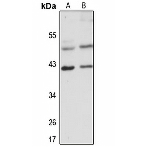 VPS26A Rabbit Polyclonal Antibody