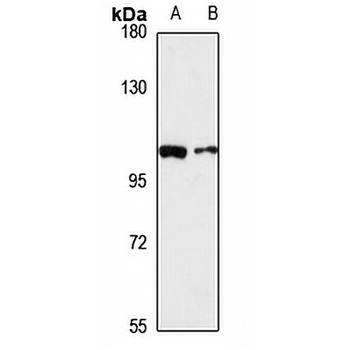 VPS39 Rabbit Polyclonal Antibody