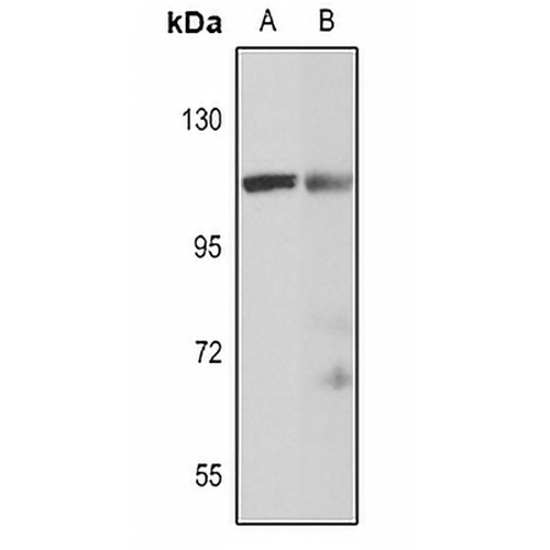 WBP11 Rabbit Polyclonal Antibody