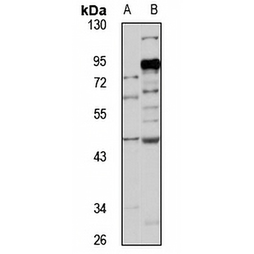 WDR4 Rabbit Polyclonal Antibody