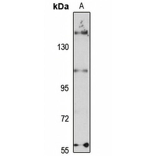WDR52 Rabbit Polyclonal Antibody