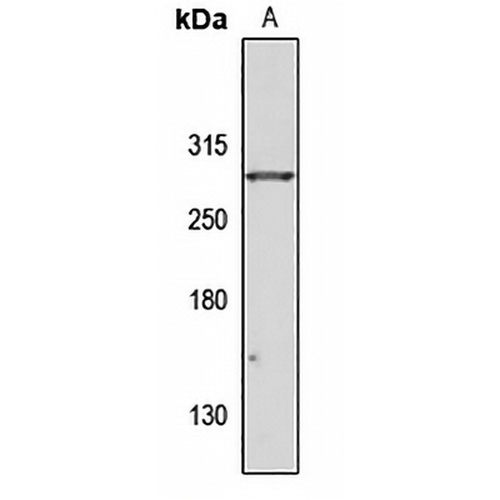 WDR81 Rabbit Polyclonal Antibody