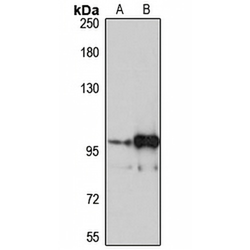HCNP Rabbit Polyclonal Antibody