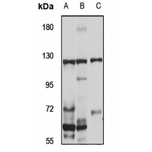 XPO7 Rabbit Polyclonal Antibody