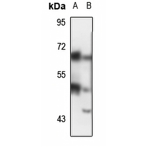 c-Yes Rabbit Polyclonal Antibody