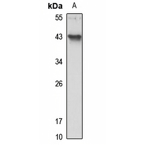 YOD1 Rabbit Polyclonal Antibody