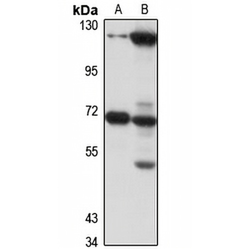 YTHDF2 Rabbit Polyclonal Antibody