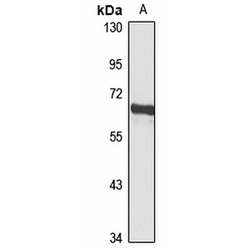 YTHDF3 Rabbit Polyclonal Antibody