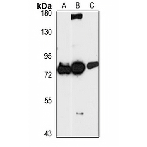 HCCA2 Rabbit Polyclonal Antibody