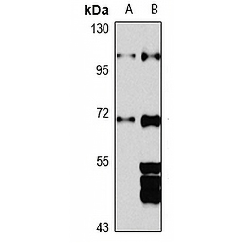 MIZ-1 Rabbit Polyclonal Antibody