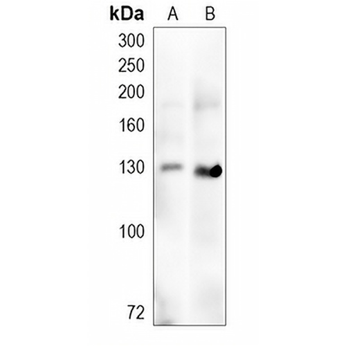 ZBTB38 Rabbit Polyclonal Antibody