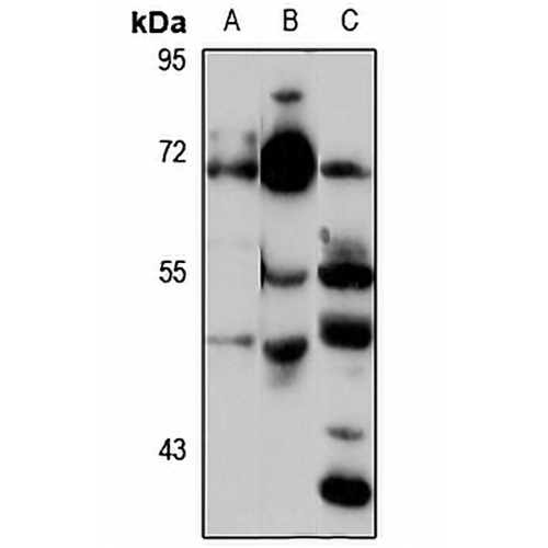 ZBTB44 Rabbit Polyclonal Antibody