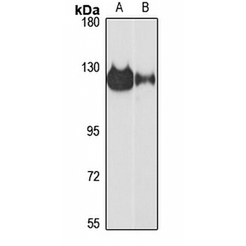 ZC3H7A Rabbit Polyclonal Antibody