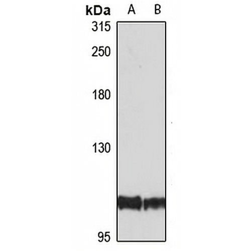 ZC3HAV1 Rabbit Polyclonal Antibody