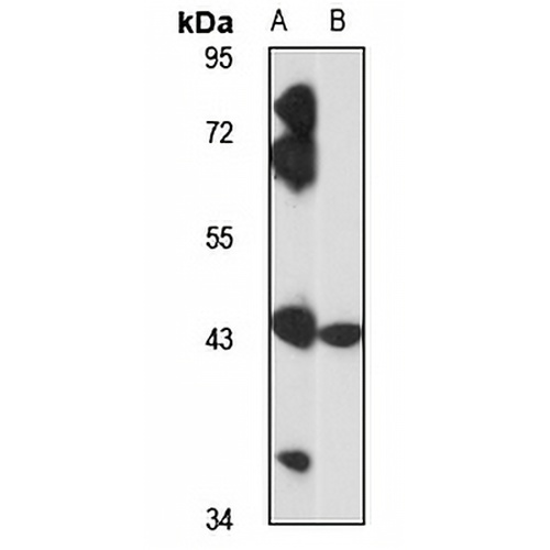 ZCCHC3 Rabbit Polyclonal Antibody