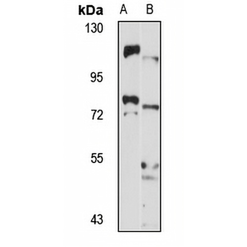 ZDHHC8 Rabbit Polyclonal Antibody