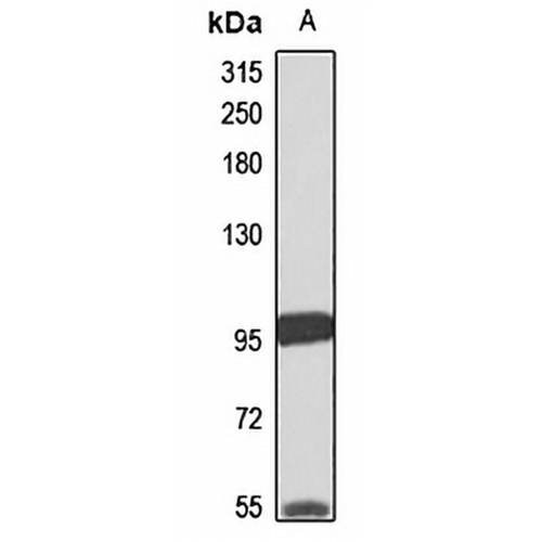 ZFYVE16 Rabbit Polyclonal Antibody
