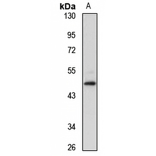ZFYVE27 Rabbit Polyclonal Antibody