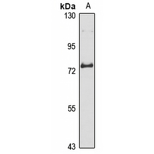 ZNF16 Rabbit Polyclonal Antibody
